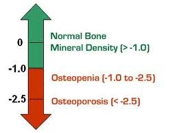 osteoporosis-treatment