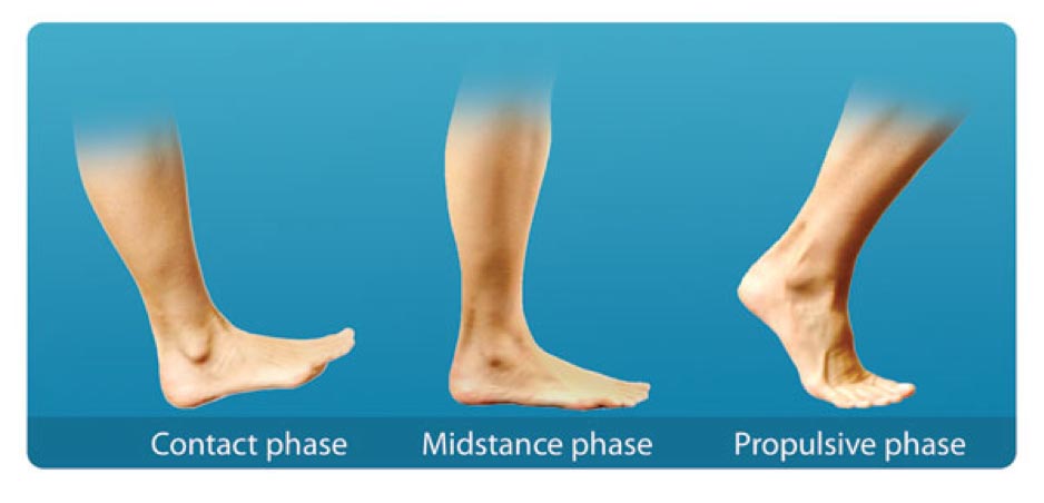 Drop Foot Phases